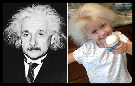 einstein syndrome|einstein syndrome wiki.